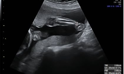 realizacion de informes en grandes clinicas